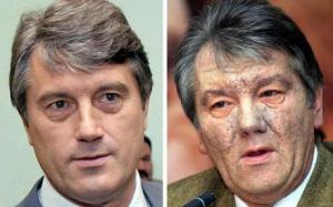 Ukraine is hard on politicians. Viktor Yushchenko before being 2004 in 2004, and after.